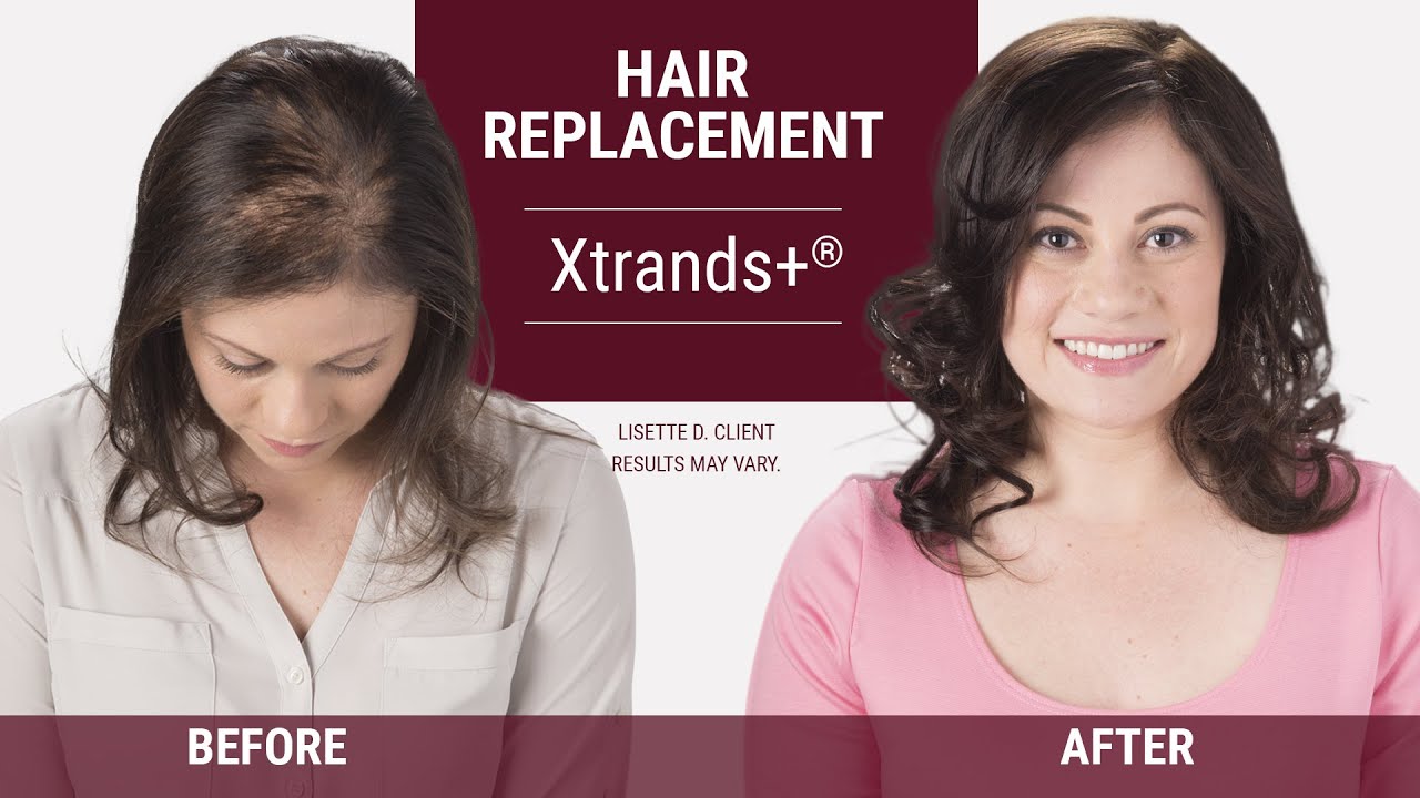 Bye-Bye bad hair days | What can women do about female hair loss?