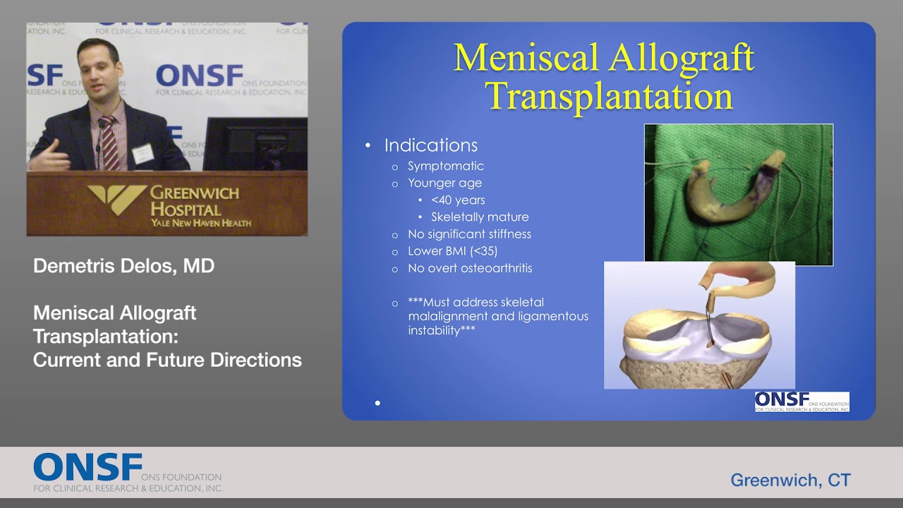 ONSF 2017 Conference: Demetris Delos, MD