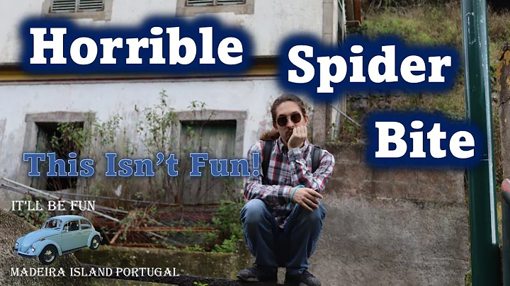 Spider Bite Or Shingles? | Madeira, Portugal | @It...