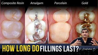 Dental Fillings - How long do they Last? Dr Arunkumar Pearls Dentistry | Dentist Chennai India