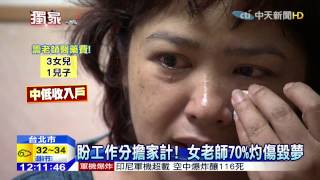 20150701中天新聞 盼工作分擔家計! 女老師70%灼傷毀夢