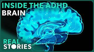 The Surprising Science of ADHD | BBC Documentary