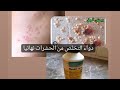 أقوى دواء لتخلص من بق الفراش والحشرات بصفة عامة
