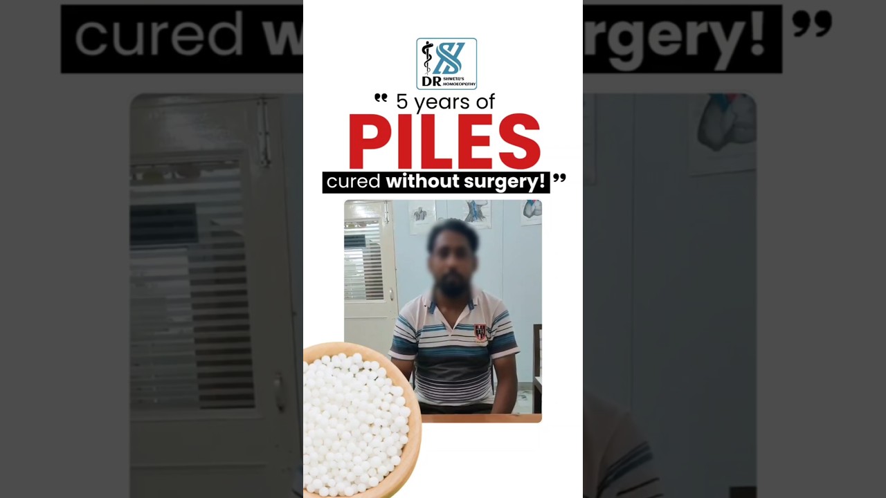 Piles Treatment Success Story | 5 Years of Pain Relieved Without Surgery | 
