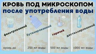Вода - лучшее средство для разжижения крови? 💦 Или совсем наоборот ?