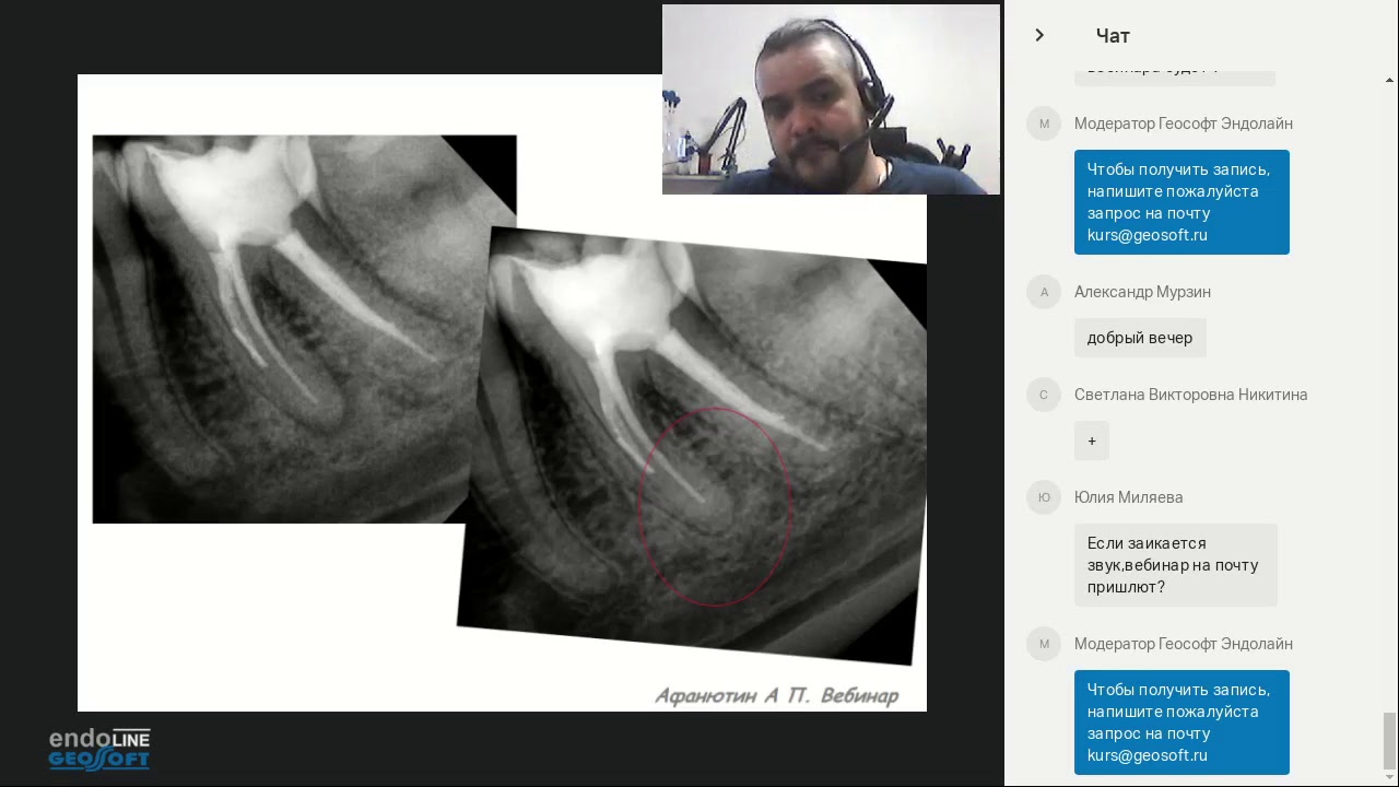 Endo.Education Вебинар Андрея Афанютина Секреты и особенности работы в зубах со сложной морфологией
