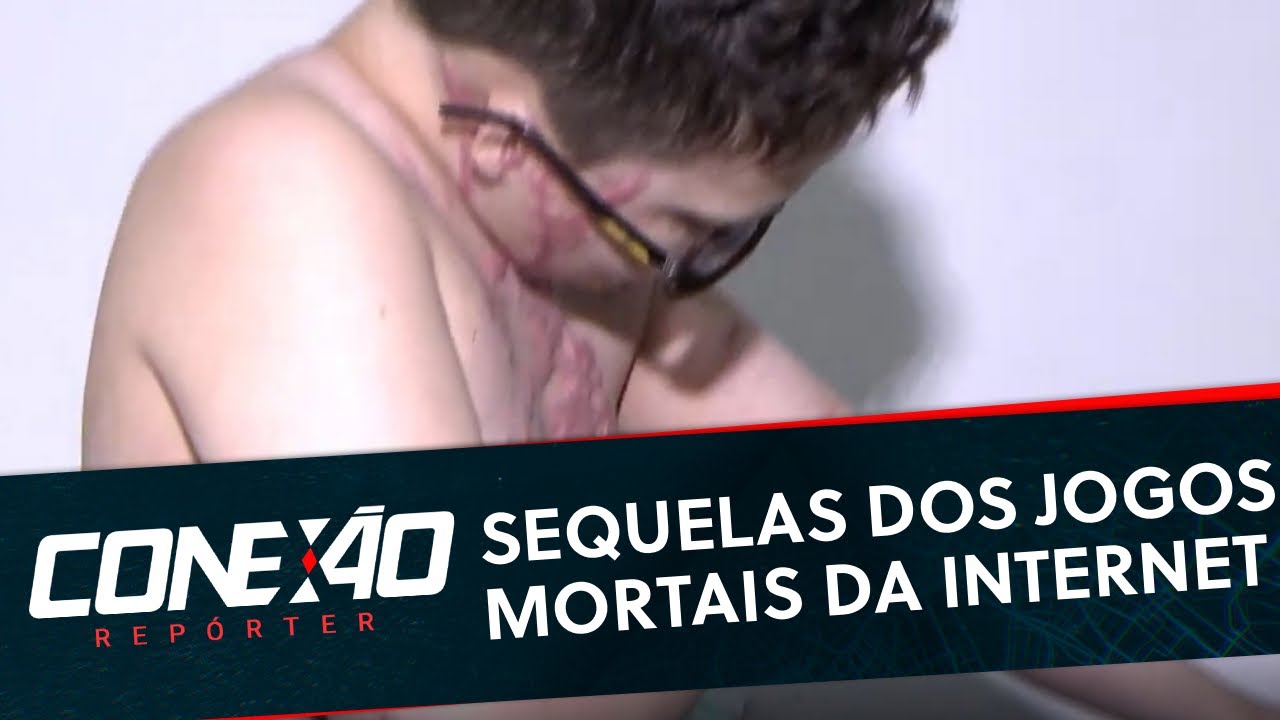 Jogos Mortais: Cabrini conversa com sobreviventes de desafios da internet | Conexão Repórter