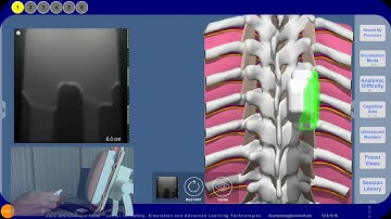 RA Simulation: Ultrasound Image Acquisition Exercise