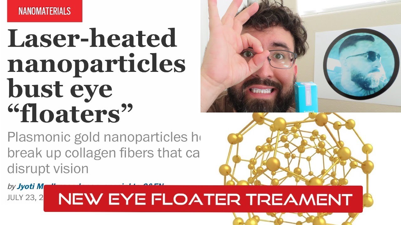(BREAKING) New Eye Floater Treatment! Using GOLD NANOPARTICLES, wow 😮