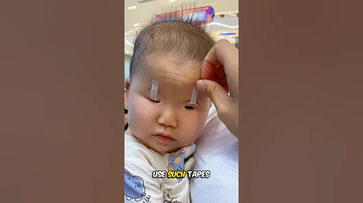 Why do Chinese apply Tape on their Children's Eyes 🤯