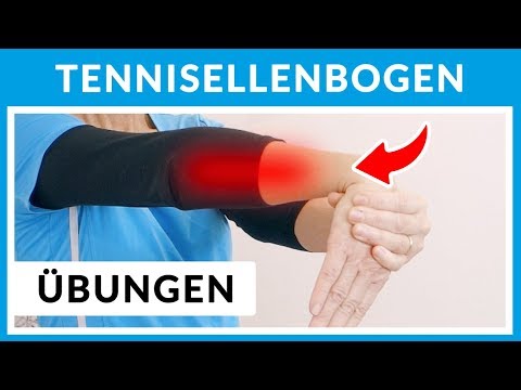 Video: Behandlung Von Epicondylitis Mit Volksheilmitteln