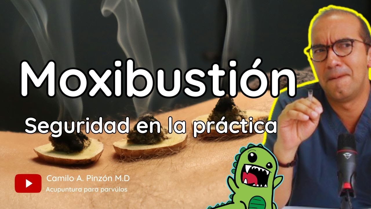 MOXIBUSTION: CONDICIONES DE SEGURIDAD 🔥🦺 | Acupuntura para párvulos.
