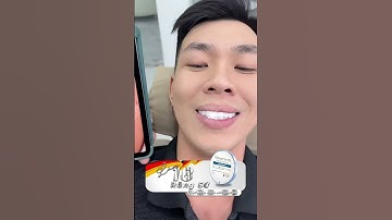 Lột xác nụ cười với 18 răng sứ Đức Cercon #drThu #BsThu #Dansuthammy #Veneer