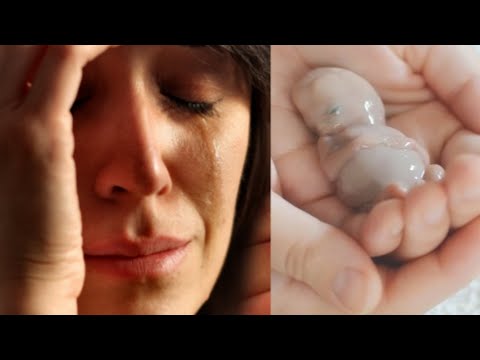 Video: Katy Perry, hamiləlik dövründə maşında kürəkəndən gizləndiyini etiraf etdi