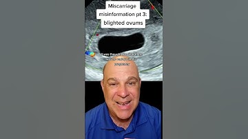 a blighted ovum is an old term for a type of early miscarriage