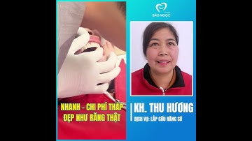 Khôi phục răng bị mất