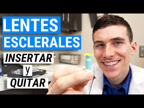 Video: ¿Se notan los lentes esclerales?