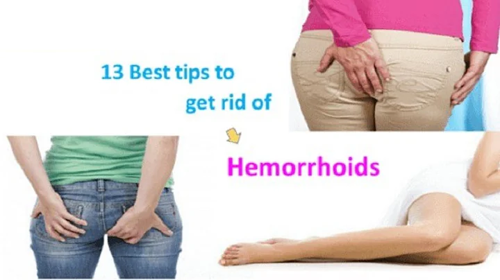 How Do You Get Rid Of Hemorrhoids - How To Cure He...