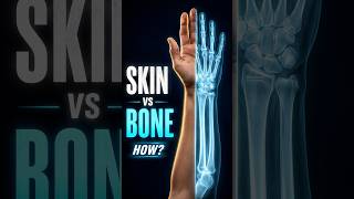 How do X-rays work? Skin vs bone, explained
