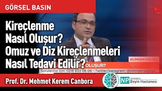 Kireçlenme Nasıl Oluşur? Nasıl Tedavi Edilir?