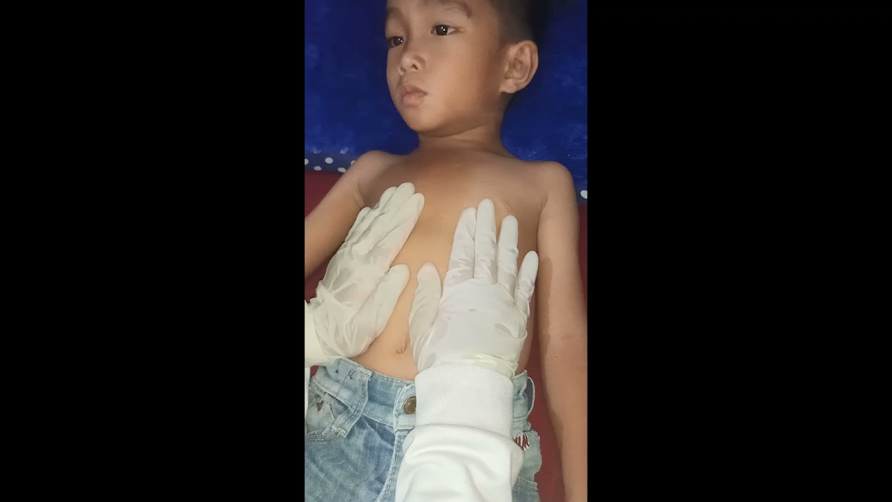 Pemeriksaan Fisik Sistem Respirasi pada Anak