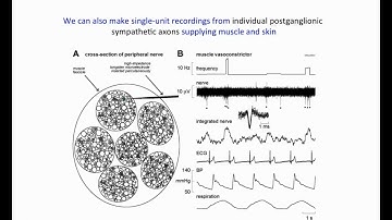 Webinar – Microneurography: Recording Nerve Traffic Via Intraneural Microelectrodes