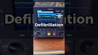 (WATCH) How to Perform Defibrillation using a Philips Intrepid Defibrillator