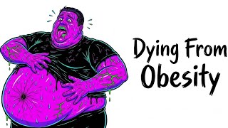 What dying from obesity feels like