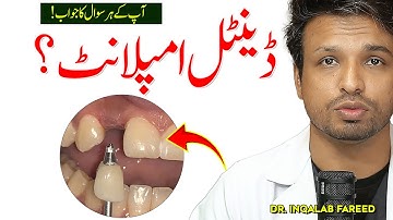 WAARSCHUWING: Laat geen tandimplantaten plaatsen voordat u dit hebt bekeken.