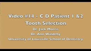 Video #14   C D Selection of Teeth