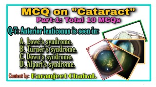 MCQ on Cataract (Part-1)