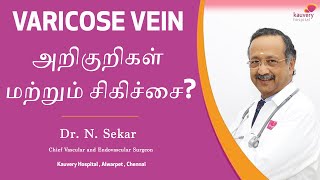 Varicose vein – Symptoms and Treatment | வெரிகோஸ் வெயின் – அறிகுறிகள் மற்றும் சிகிச்சை