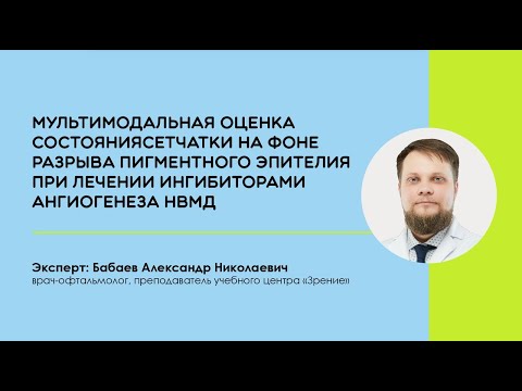 Вебинар: Мультимодальная оценка сетчатки на фоне разрыва пигментного эпителия. Бабаев А.Н.