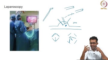 Contrast Enhancement