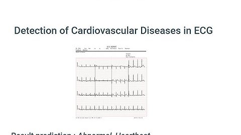 Detection of Cardiovascular Diseases in ECG Images Using Machine Learning and Deep Learning Methods