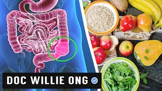 CONSTIPATION: Prevention \& Natural Remedies -- Dr Willie Ong Health Blog #16b