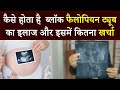 Fallopian Tube Block होने के बाद भी  नेचुरल तरीके  से मां बनना है संभव, जानें इसके बारे में