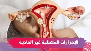 بينها الحكة.. أعراض الإفرازات المهبلية غير العادية