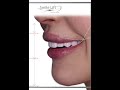 YOUTUBE TITLESmile Infinity: Aesthetic, Sports Medicine & Longevity. Global Medical Excellence.