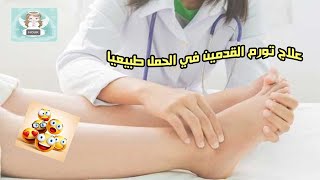 علاج تورم القدمين في الحمل طبيعيا