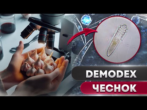 Чеснок против клеща | Угревая Железница Demodex