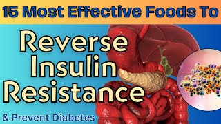 15 Most Effective Foods to Reverse Insulin Resistance | Improve Insulin Sensitivity