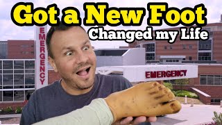 I GOT A NEW FOOT That Changed My Life