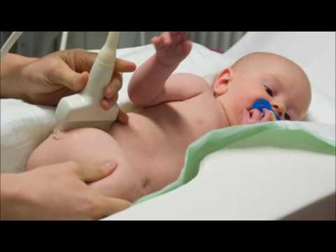 USG bioderek niemowląt - dysplazja - dr n med  Radoslaw Lebiedzinski z Kliniki Alfa w Sochaczewie
