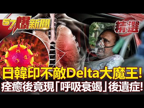 日韓印不敵Delta大魔王！染疫痊癒竟出現後遺症「呼吸衰竭」！- 汪潔民 黃創夏 江中博【57爆新聞 精選】