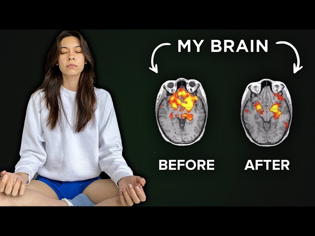 How 6 Weeks Of Meditation Can Literally Change The Brain class=