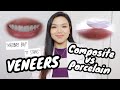 VENEERS: Composite vs. Porcelain 🦷 | WHAT YOU NEED TO KNOW | Dentist Philippines | Dr. Bianca Beley