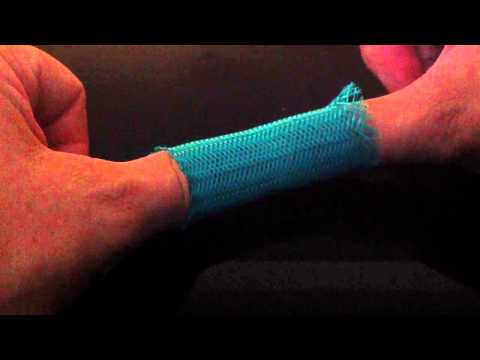 How to escape a finger trap
