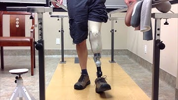 Dynamic Alignment | limb-loss.org