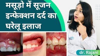 घरेलू उपचार: मसूड़ों के दर्द और सूजन से छुटकारा पाने के लिए अद्भुत नुस्खा